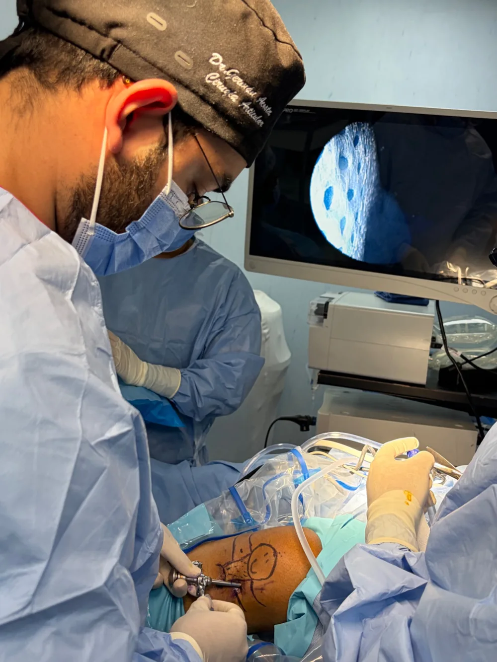 Equipo médico realizando artroscopia de rodilla